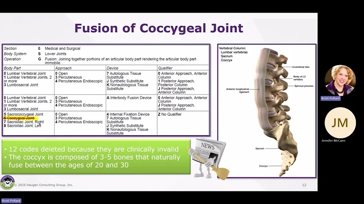 HCGTV: Webinar Snippet - 2025 ICD-10-PCS Updates: Coding Fusion of Coccygeal Joint