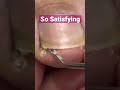 Cleaning The Fuzz Out Meticulousmanicurist Pedicure Cleaning Cleaning The Fuzz Out Meticulousmanicurist Pedicure Cleaning
