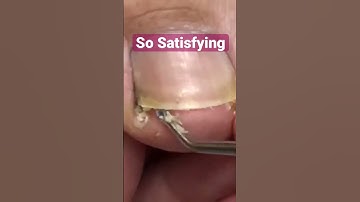 Cleaning the fuzz out. #meticulousmanicurist #pedicure #cleaning