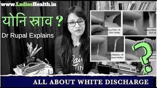 Ladies White discharge योनि स्राव leucorrhoea के 5 प्रकार & उनका क्या मतलब #LadiesHealth