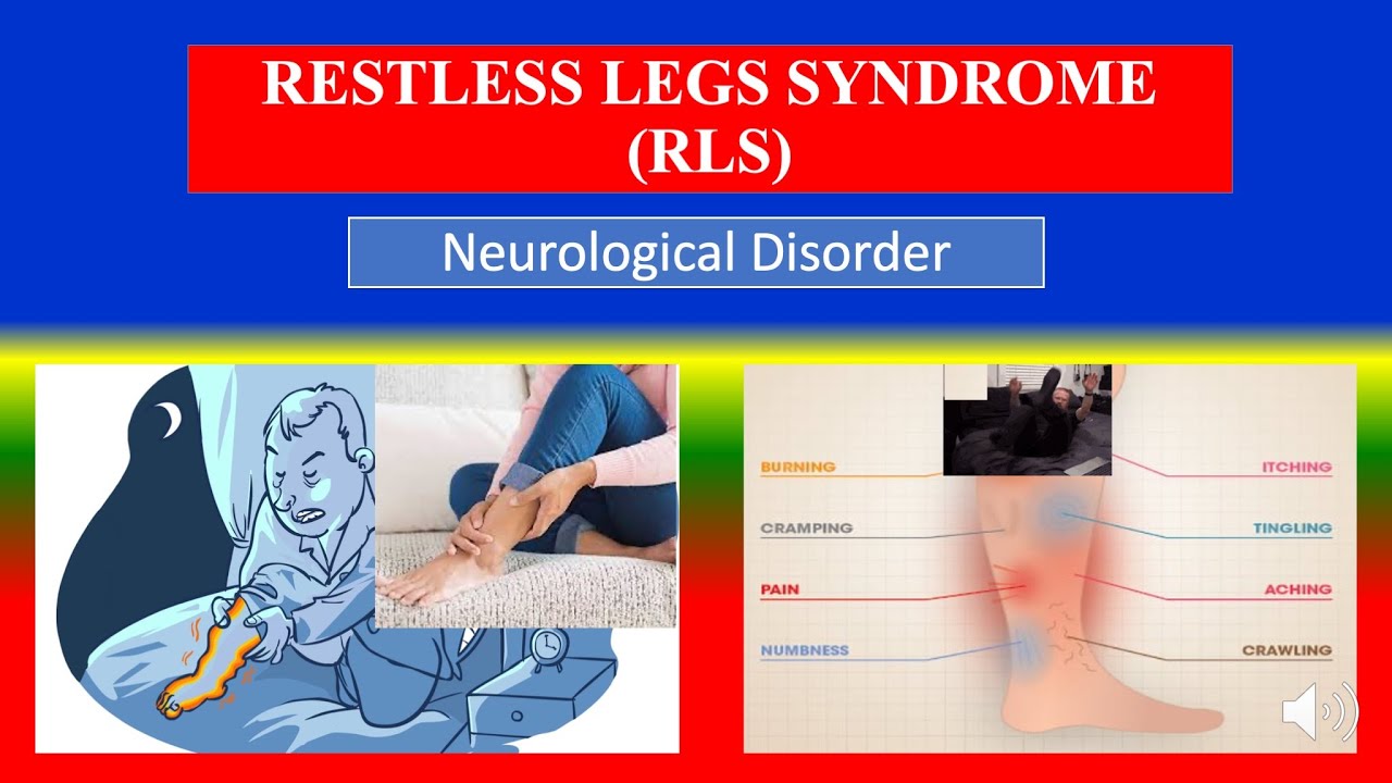 RESTLESS LEGS SYNDROME (RLS) - Definition, types, causes ...