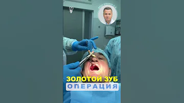 Удаление золотого зуба.