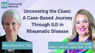 Uncovering the Clues: A Case-Based Journey Through ILD in Rheumatic Disease