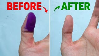 Remove All Ink From Hand INSTANTLY! 🔥 (Secret Trick!)
