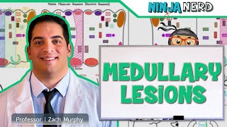 Medullary Lesions: Medial and Lateral Medullary Syndromes