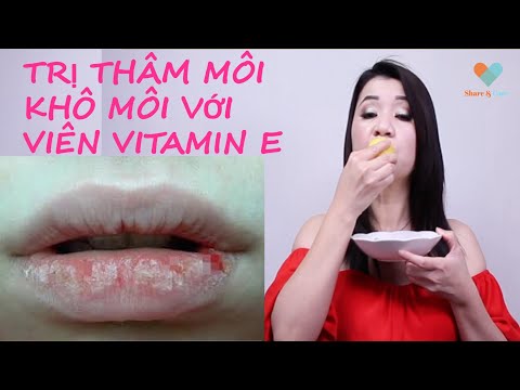 Cách Trị Thâm Môi Bằng Vitamin E Khiến Bạn Bất Ngờ / Lighten Dark Lips Naturally with Vitamin E