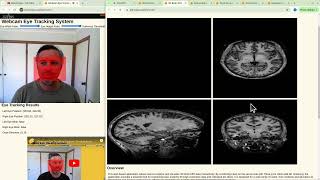 Celebrity Exploring High-Resolution 3D Brain Models โ Fast Loading & Interactive Features! Net Worth