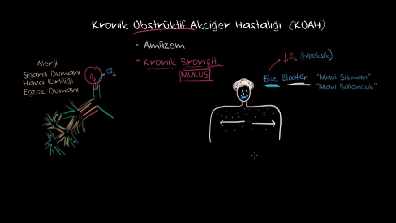 Kronik Bronşit Nedir? (Solunum Sistemi Hastalıkları | Sağlık Bilgisi ve Tıp)