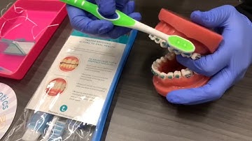 How To Properly Brush Your Teeth With Braces