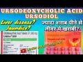 Udiliv tablet / Hepakind tablet / Ursodeoxycholic acid tablet,  uses, side effects