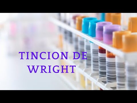 Video: ¿Cómo se hace una mancha de Wright?