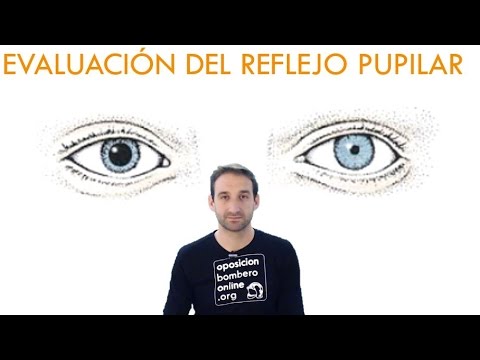 Video: ¿Las pupilas puntiformes reaccionan a la luz?