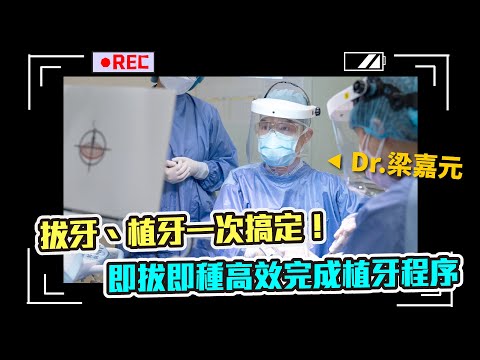 【專訪】拔牙後立即植牙 是可能的嗎  立即植牙讓您快速展笑顏 ft.梁嘉元主任
