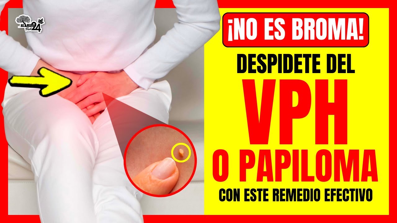 🔴✅ Como Tratar el VIRUS DEL PAPILOMA HUMANO en HOMBRES y MUJERES con este Potente Remedio