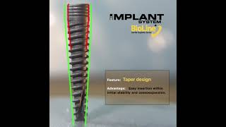 iSURFACE Implant by iIMPLANT SYSTEM_BIOLINE®