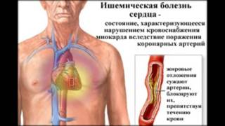 болезни сердца у собаки симптомы и лечение болезни сердца у собаки симптомы и лечение
