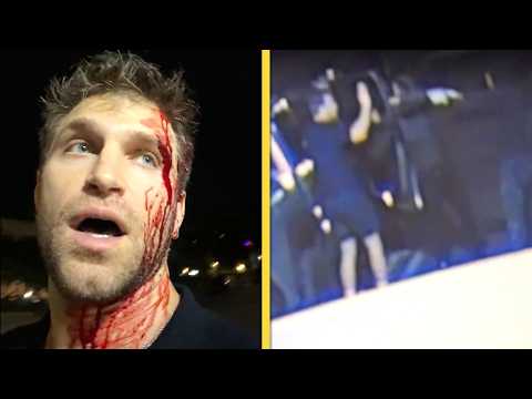 Pretty Little Liars’ Keegan Allen BLOODIED After Robbery at Gunpoint