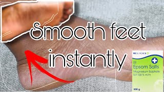 HOW TO HAVE SMOOTH FEET NATURALLY AT HOME  *INSTANT RESULTS* screenshot 4