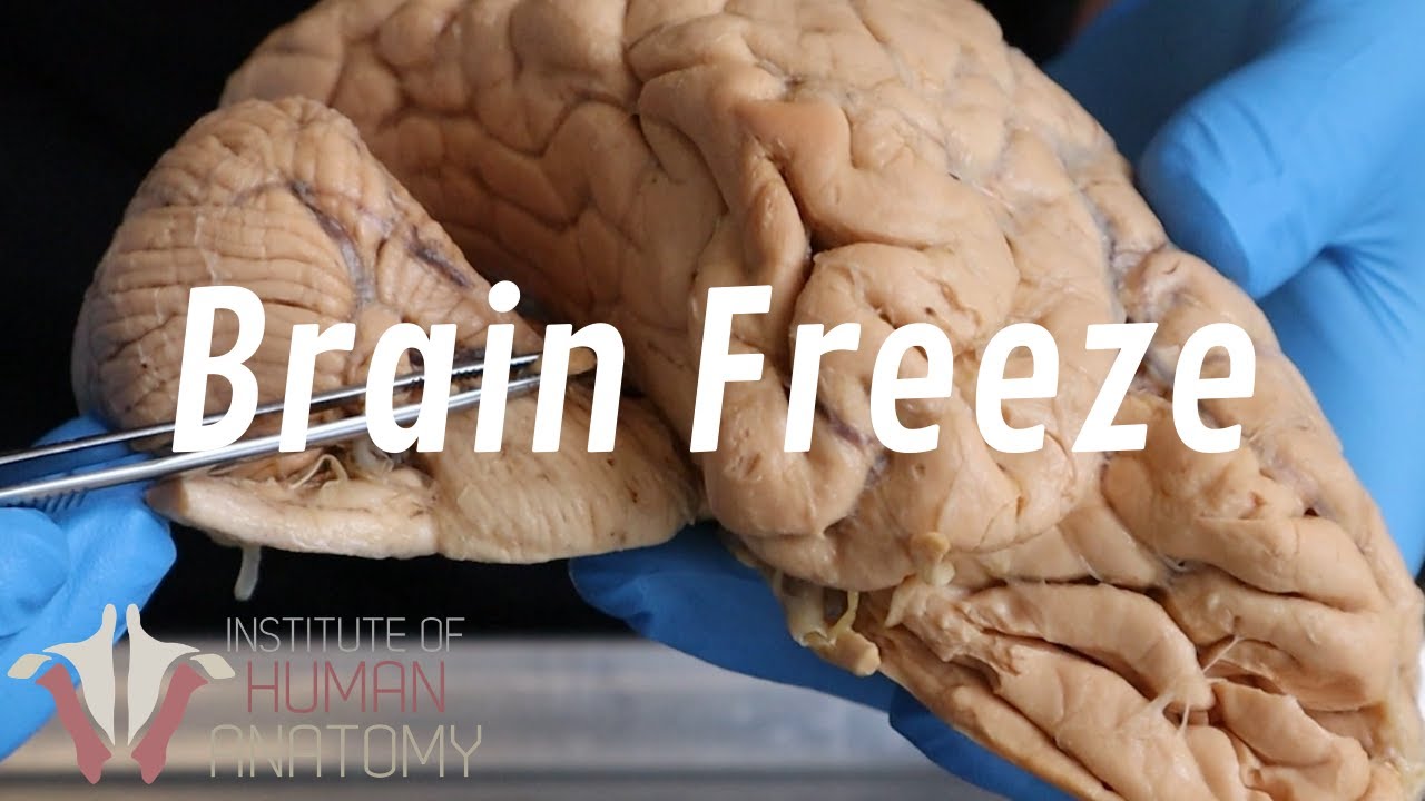 What Happens When You Have a Brain Freeze