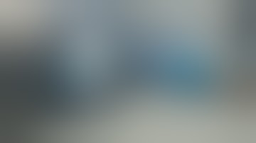 Teleproctoring for Complex RATS Cases: Bronchoplastic Right S6 Segmentectomy