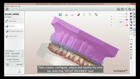 Bite Rising Splint Design in @3shape