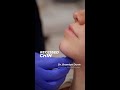 Reclaim our profile with expert chin contouring 💎