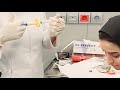 SVF from Fat;Under-Eye Rejuvenation&amp;Scar Treatment Technique / برداشت چربی و تهیه Svf