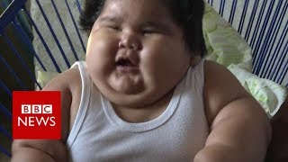 Why is this baby so overweight?  BBC News