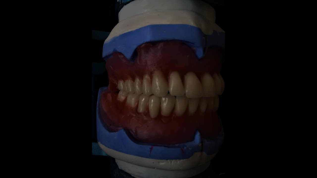 Total Protezlerde Posterior Diş Dizimi-Complete Dentures Posterior Teeth Setup