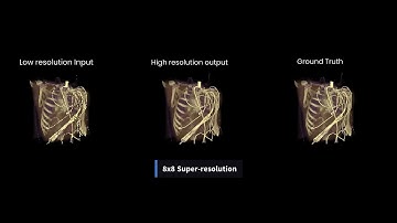 Deep Learning based Super-Resolution for Medical Volume Visualization