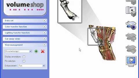 VolumeShop: An Interactive System for Direct Volume Illustration (1)
