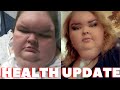 Tammy Slaton's Unbelievable Health Update