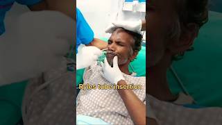 Ryles Tube Insertion Procedure