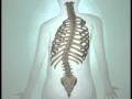 Teen Scoliosis Causes and Treatment Options- DePuy Videos