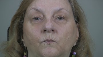 Botox for the Treatment of Blepharospasm