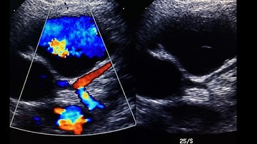 How to Image Coronary Arteries: Step by Step