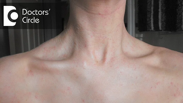 What causes a sudden red rash around the neck in w...