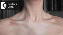 What causes a sudden red rash around the neck in women? - Dr. Aruna Prasad