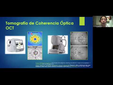 Oct de Nervio Óptico Mácula en Glaucoma