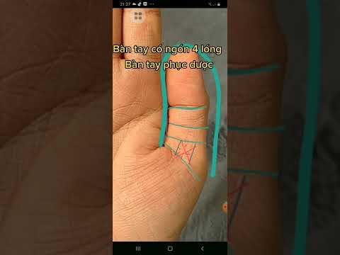 Video Bàn tay có ngón 4 lóng Bàn tay phục dược - youtube