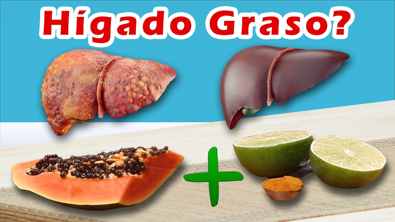 Alimentos para higado graso