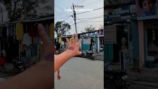 Saharsa me Free fibroscan camp 😱 #saharsa #viral #minivlog #trending #vlog #fibroscan#liver#ytshorts