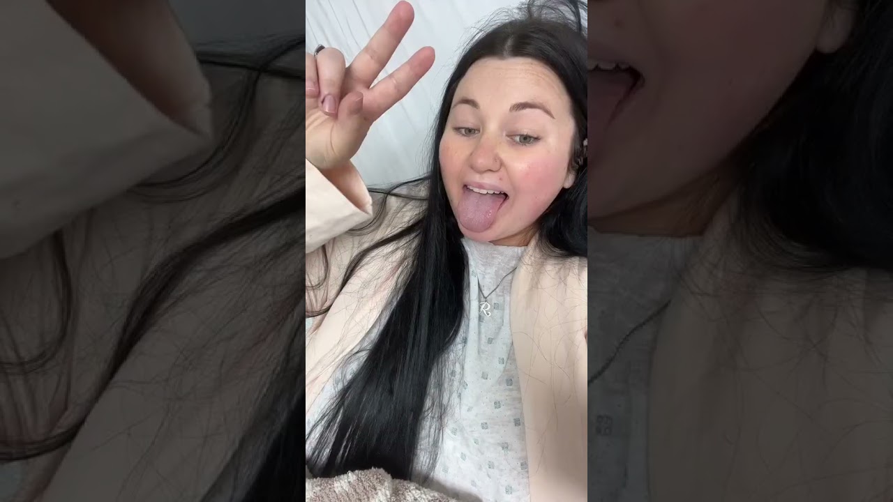 Getting Gastric Sleeve in Tijuana