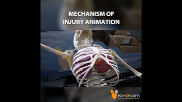 Mechanism of Injury Animation