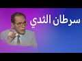 دكتور مصطفى محمود سرطان الثدي 