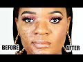 LARGE PORES? ACNE SCARS?? BUMPY SKIN??? HOW TO COVER PROBLEMATIC SKIN WITH MAKEUP | OMABELLETV