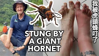 Stung by an Asian giant hornet (aka Murder Hornet) | 我被虎頭蜂叮了 (有中文字幕)