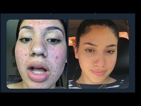 My Skin Care Routine (: - YouTube