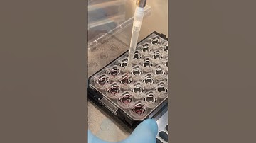 Handling the µ-Plate 24 Well for Membrane Inserts #CellCulture #Microscopy #Transwell  #imaging