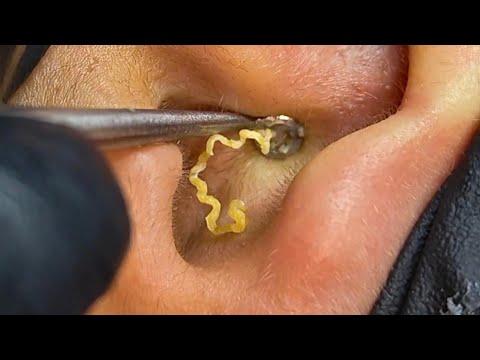 Unbelievably Satisfying! Watch Till The End For The Perfect Clean 👂🔥 ASMR